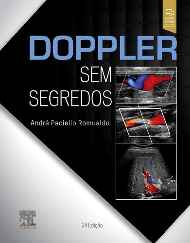 Doppler Sem Segredos