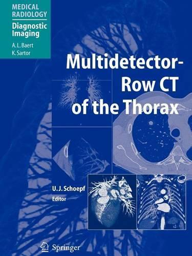 Multidetector-Row CT of the Thorax