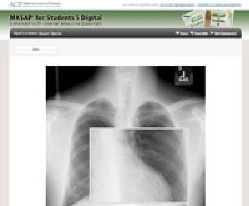 MKSAP for Students 5 Digital: Enhanced with Internal Medicine Essentials