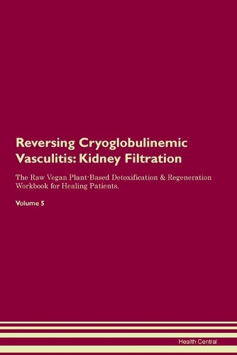 Reversing Cryoglobulinemic Vasculitis