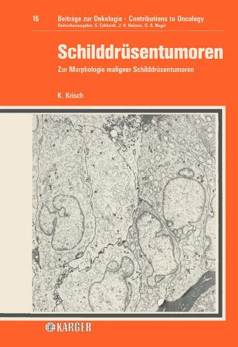 Schilddrüsentumoren: Zur Morphologie maligner Schilddrüsentumoren. Eine retrospektive Studie anhand von 981 Fällen mit Berücksichtigung des Einflusses der Jod-Kochsalz-P(16 Contributions to Oncology)